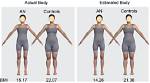 Anorexia Recovery and Body Acceptance