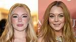 Before and After Plastic Surgery Revelations