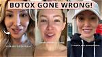 Botox Went Wrong: Understanding the Risks and Consequences