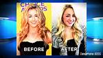 Chloe Lukasiak's Eye Condition Explored