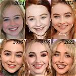 Dramatic Transformation: Sabrina Carpenter's Evolving Facial Features