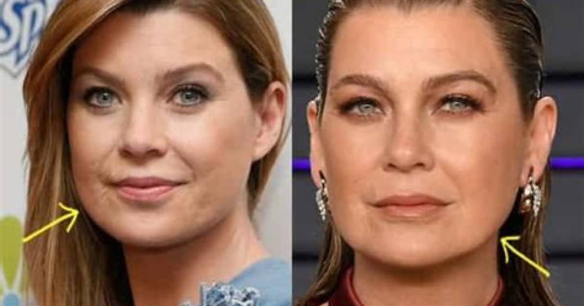 Ellen Pompeo's Scar: the Story Behind Her Iconic Mark