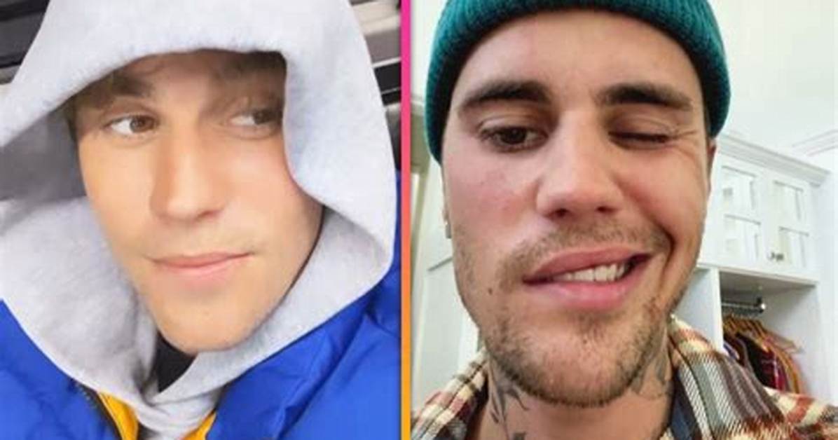 Is Justin Bieber Still Alive? Breaking News and Updates