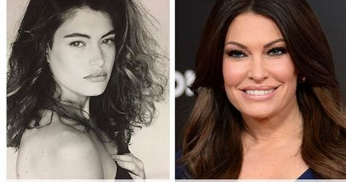Kimberly Guilfoyle: Unveiling Her Pre-Botox Transformation