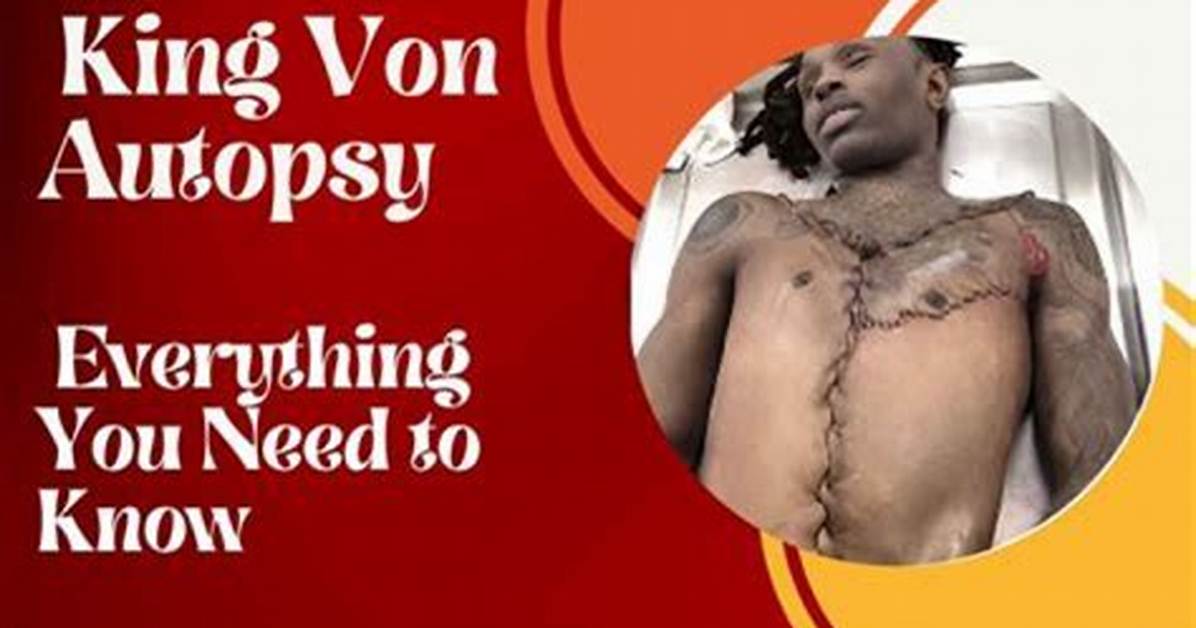 King Von Wounds: the Story Behind the Legend