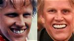 Kyle from the Challenge's Teeth Before and After Revealed ·
