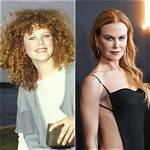 Nicole Kidman's Plastic Surgery Journey: Rumors and Revelations