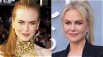Nicole Kidman: the Transformation Through Plastic Surgery in Northman
