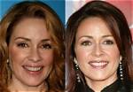 Patricia Heaton Cosmetic Surgery: Before and After Transformations