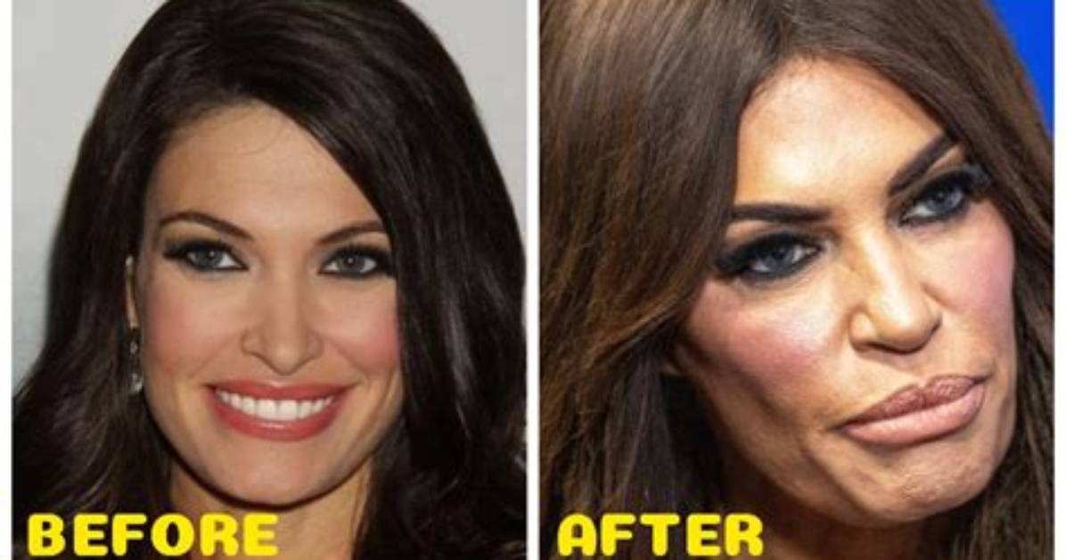 Transformations and Revelations: Kimberly Guilfoyle Before Surgery