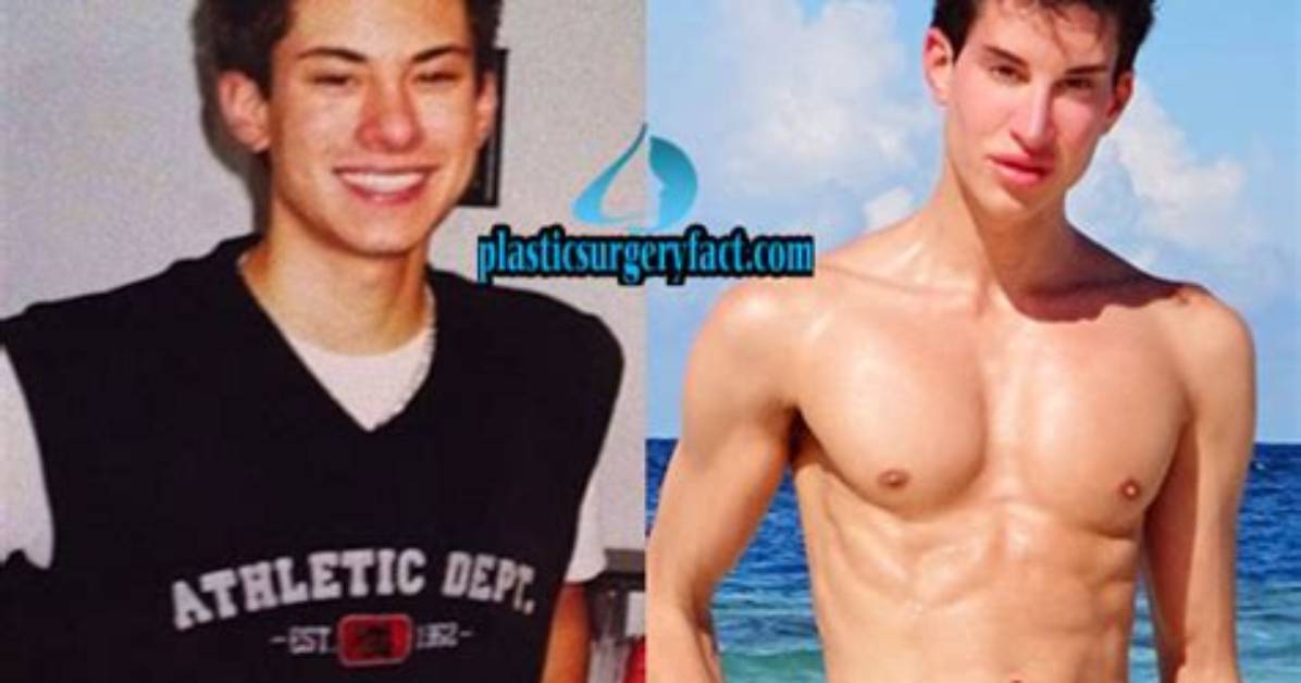 Transformative Journey: Justin Jedlica Before Plastic Surgery