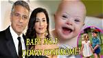 Understanding George Clooney's Son and Down Syndrome: a Journey of Love and Acceptance