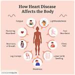 Understanding the Causes Behind Big Pokey's Death: Heart-Related Concerns