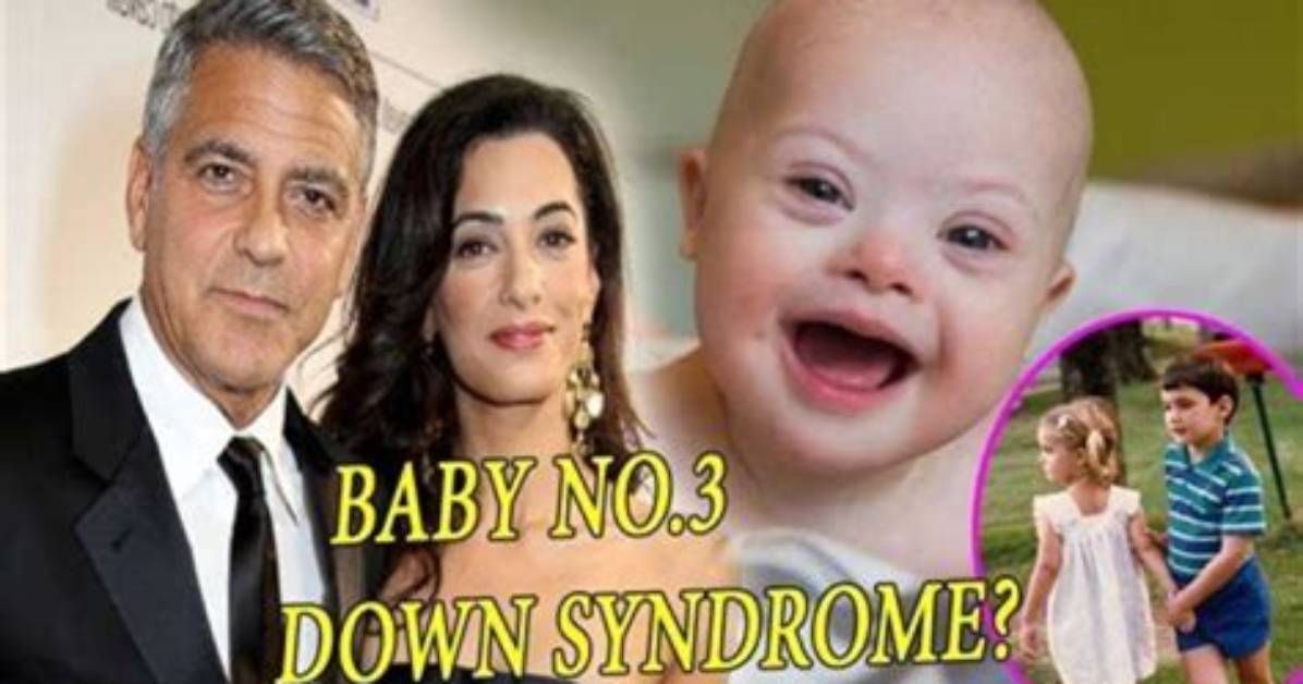 Understanding the Truth: Does George Clooney's Son Have Downs?