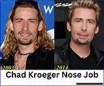 Unveiling the Age of Chad Kroeger: a Journey Through Time