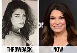 Unveiling the Transformation: Kimberly Guilfoyle Before Plastic Surgery