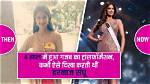 What Did Harnaaz Sandhu Look Like Before and After Plastic Surgery?